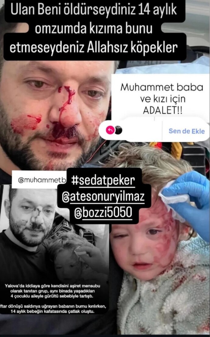 Bir bebeğe yapilirmi bu?