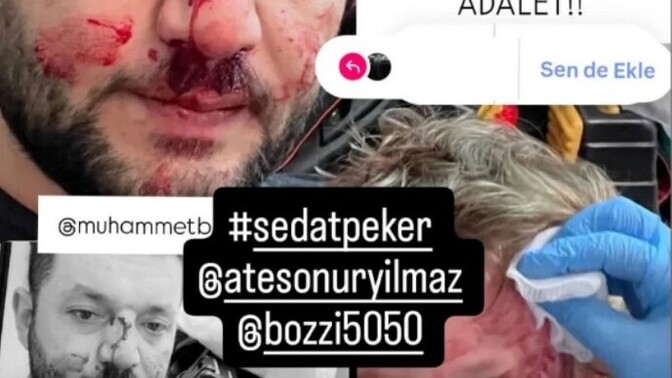 Bir bebeğe yapilirmi bu?