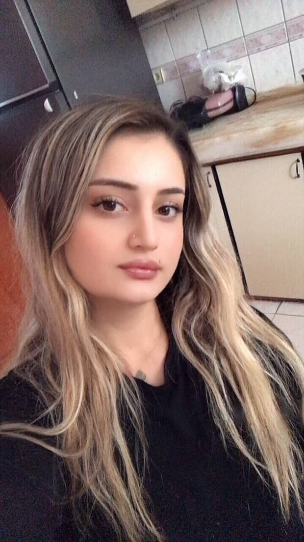 Burun estetiğim sizce doğal duruyor mu, önceki halimi bilmeyen ameliyat olduğumu anlar mı?
