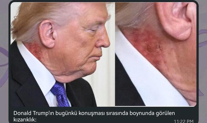 Siz ne düşünüyorsunuz nedendir bu?