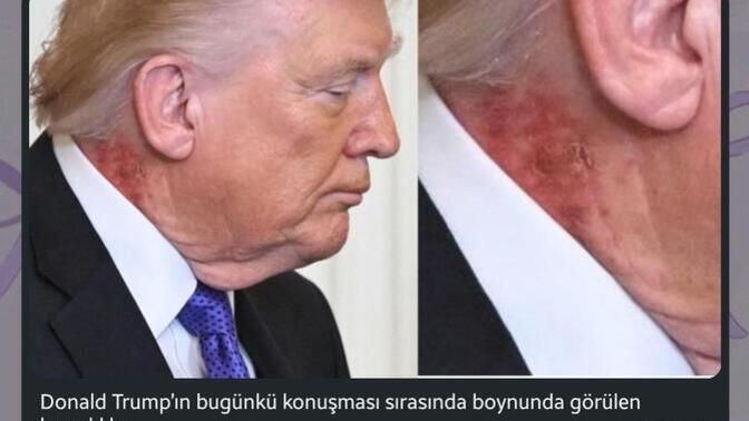 Siz ne düşünüyorsunuz nedendir bu?