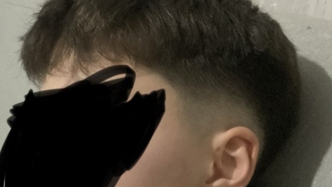 21 yaşıma gircem ona rağmen yüzümde tek bi tüy çıkmıyor yüzüm böyle. Napmalıyım?
