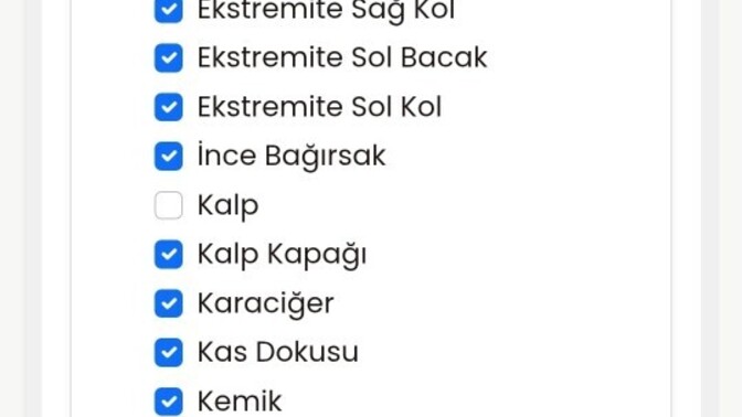 Organ bağışı hakkında fikirleriniz neler?