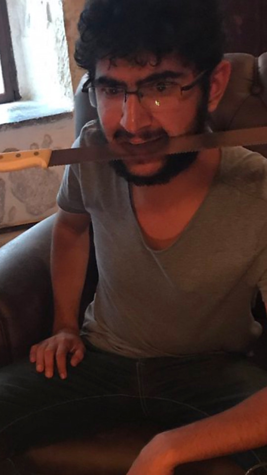 Diyet yaparken başına bu gelen var mı?