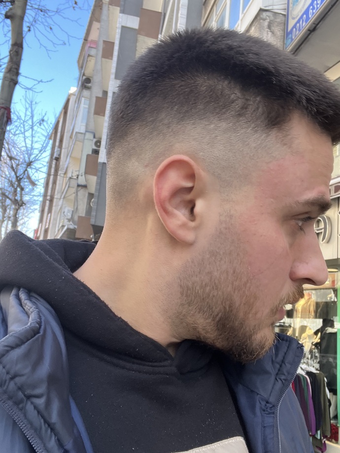 Bu Keko Traşı mı?