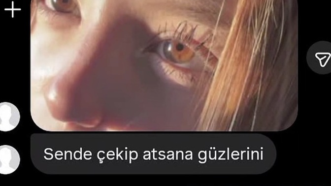 Gözleriniz güzel mi?