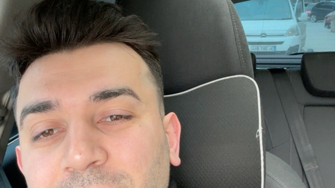 Sakalsız kötü olmuş mu Tombiş chefiniz?