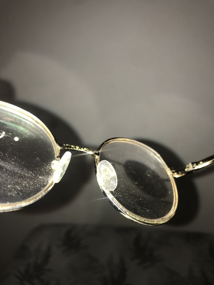 Gözlük 👓 burunluları neden yeşilleniyor?