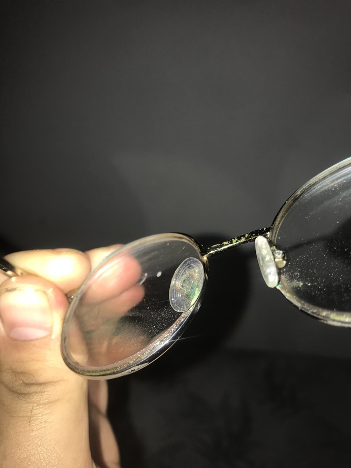 Gözlük 👓 burunluları neden yeşilleniyor?
