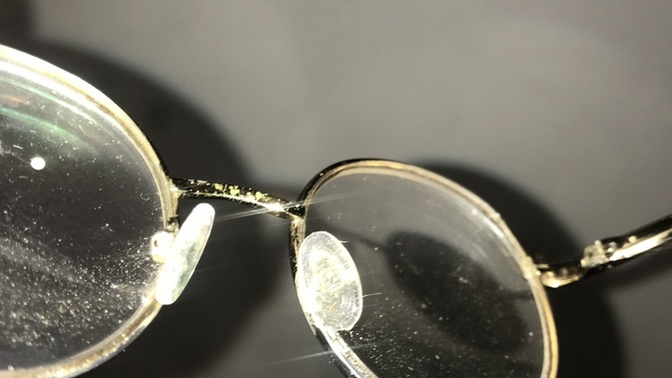 Gözlük 👓 burunluları neden yeşilleniyor?