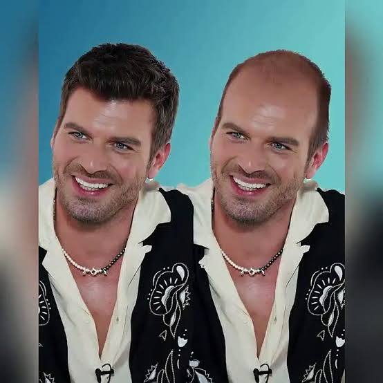 Kıvanç tatlıtuğ kel olsaydı yinede yakışıklı bulur muydunuz?