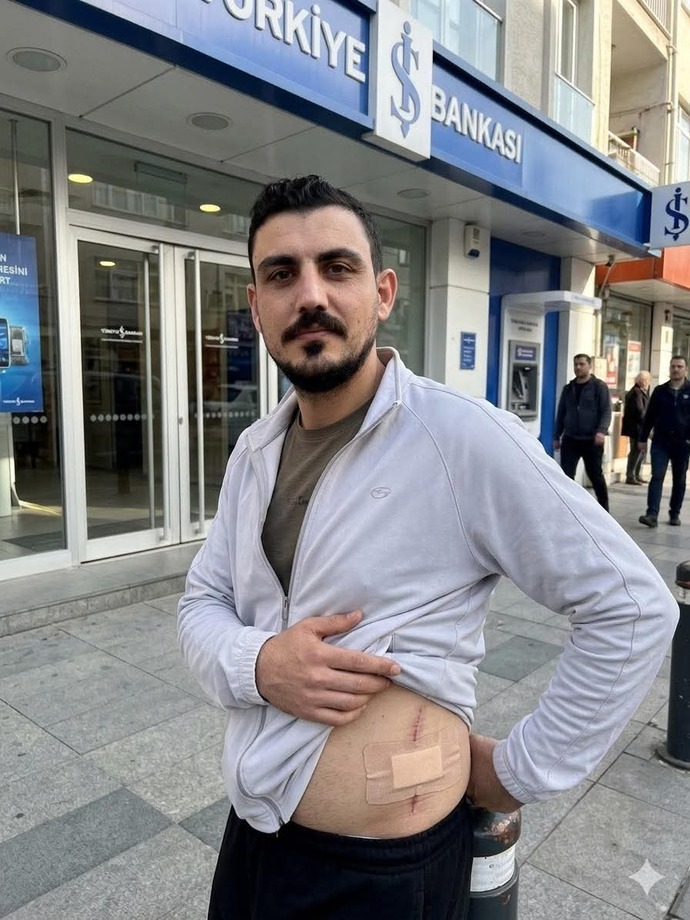 Adana’da bir vatandaş böbreğini satıp kredi borçlarını kapattı. Siz olsanız ne yapardınız?