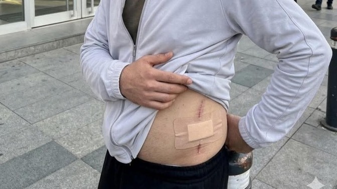 Adana’da bir vatandaş böbreğini satıp kredi borçlarını kapattı. Siz olsanız ne yapardınız?