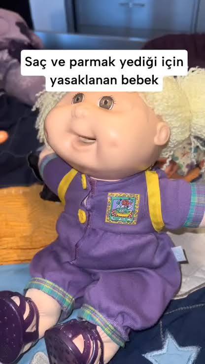 Hiç saç yiyen bebek gördünüz mü?