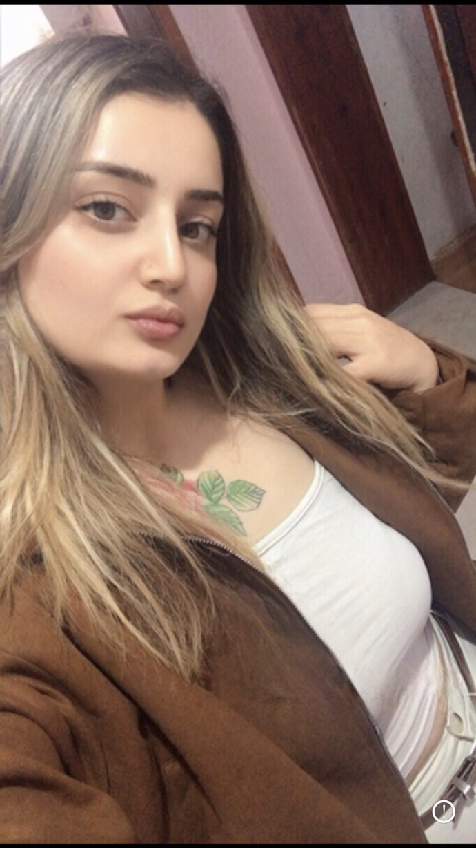 Burun estetıgım nasıl olmuş doğal ıstedım ilk resım olmamış halım ıkıncı estetık olmus halım?
