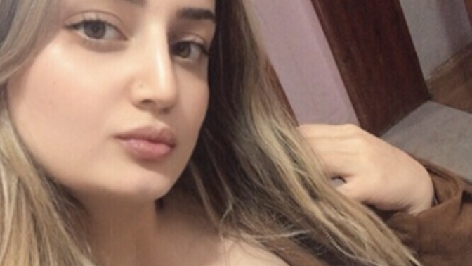 Burun estetıgım nasıl olmuş doğal ıstedım ilk resım olmamış halım ıkıncı estetık olmus halım?