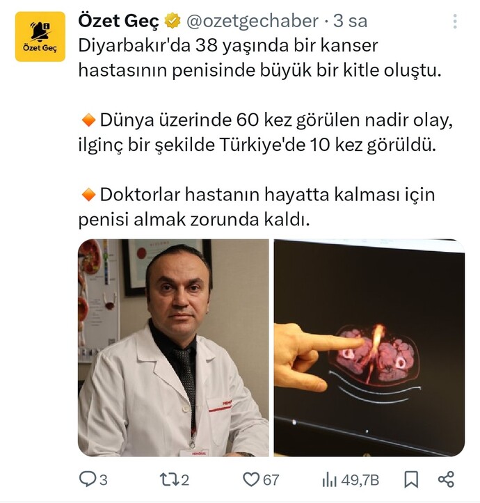 Yeni bir fobi edindim.. yok mu bir hayırlı olsun?