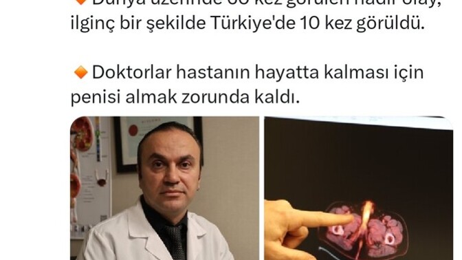 Yeni bir fobi edindim.. yok mu bir hayırlı olsun?
