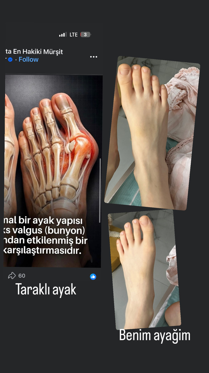 Benim ayağım tarakli mi soldaki gibi?