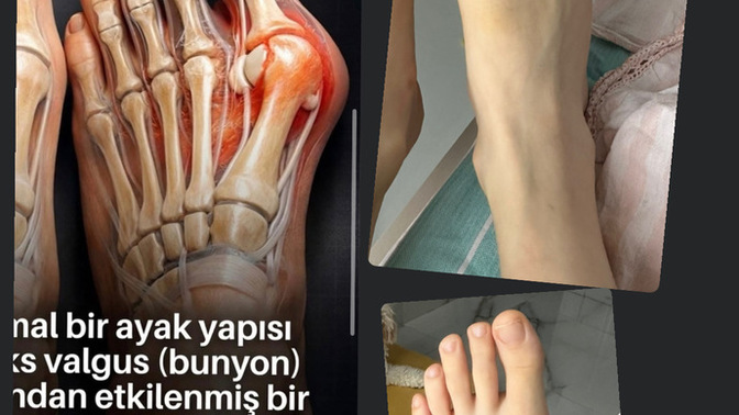 Benim ayağım tarakli mi soldaki gibi?