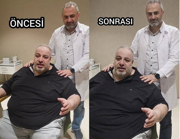 Diyet yaparken sık sık tartılmak mı daha mantıklı yoksa aynadan before/after yapmak mı?