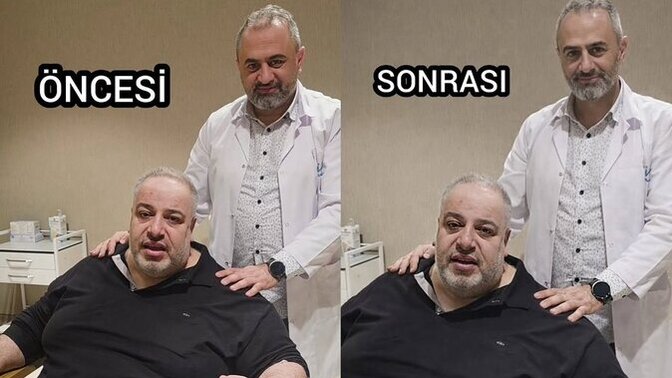 Diyet yaparken sık sık tartılmak mı daha mantıklı yoksa aynadan before/after yapmak mı?