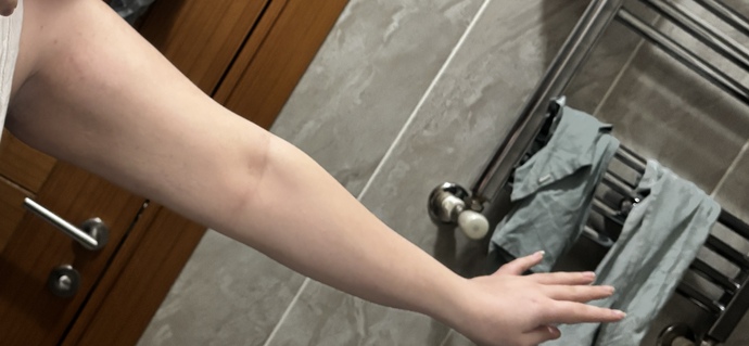 30-35 kilo verince kollarım kesin sarkar mı, şimdiden önlem almak için ne yapabilirim?