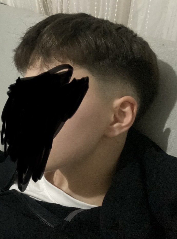 mk yüzümü skip atıcam tövbe estağfurullah bu ne aq 15 yaşında gibi duruyom genlerimi skiym