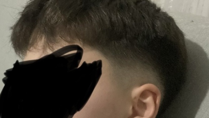 20 yaşında olmama rağmen yüzümde tek bi tüy cıkmıyo bu kötü bisey mi?