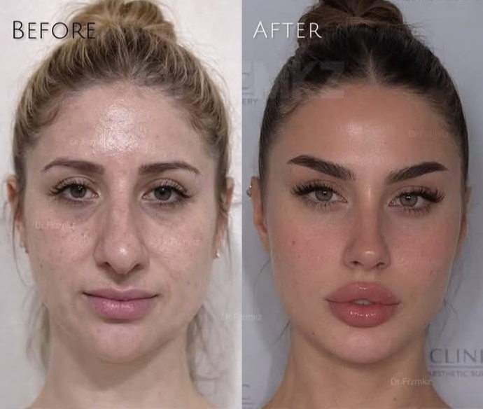 Glow-up/Güzelleşme bakımı geçirecek olsanız ilk üç sırayı hangi bakımlar alır?