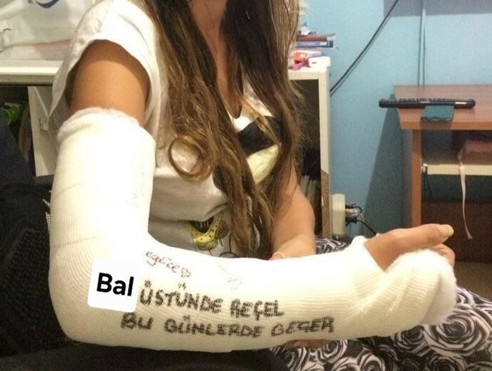 Hiç sakatlanıp, alçıya alındınız mı?