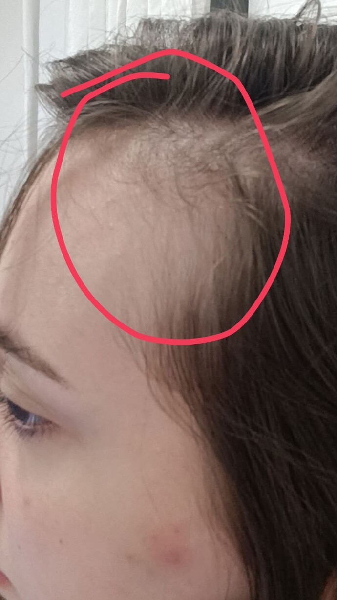 Ben mi gereksiz abartıyorum yoksa genetiğim mi anormal?