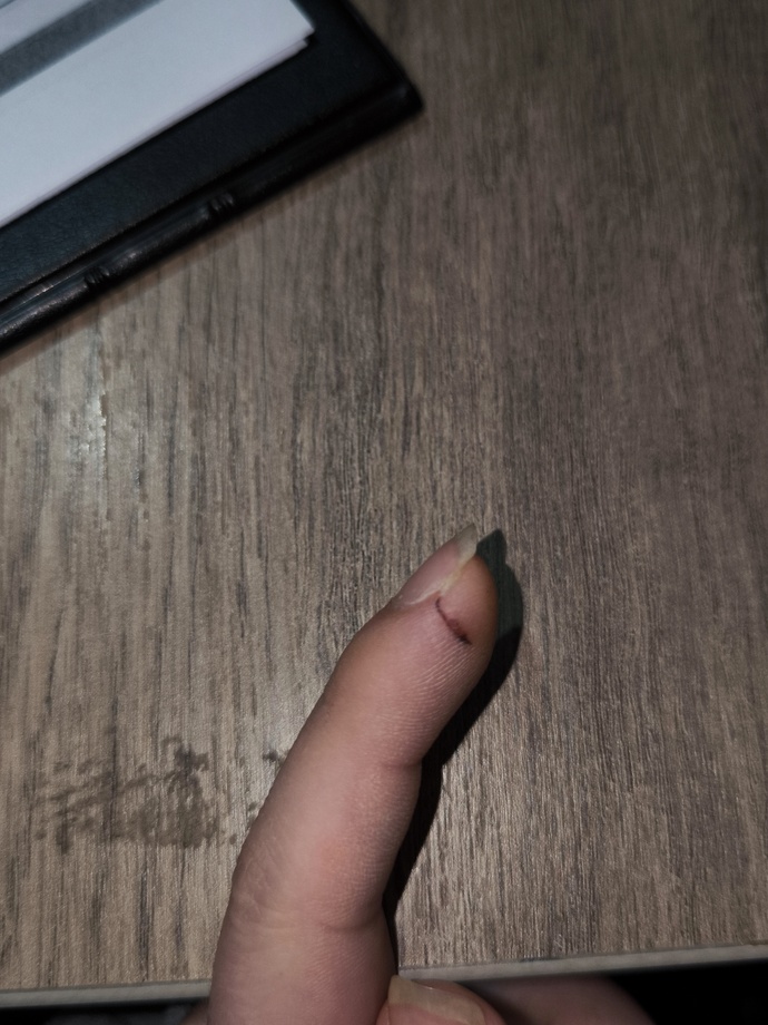 Elimi bıçakla kestim 1 aydır tam iyileşmedi, parmak ucum soğuk ve uyuşuk, sinir hasarı mı var ne yapmalıyım?