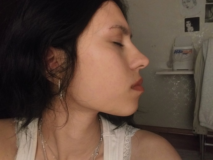 Çene ameliyatı olmayı düşünüyorum sizce?