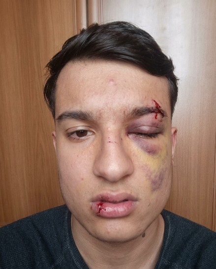 Sapıklar dan dayak yedim doğru olan yapmışmıyım?