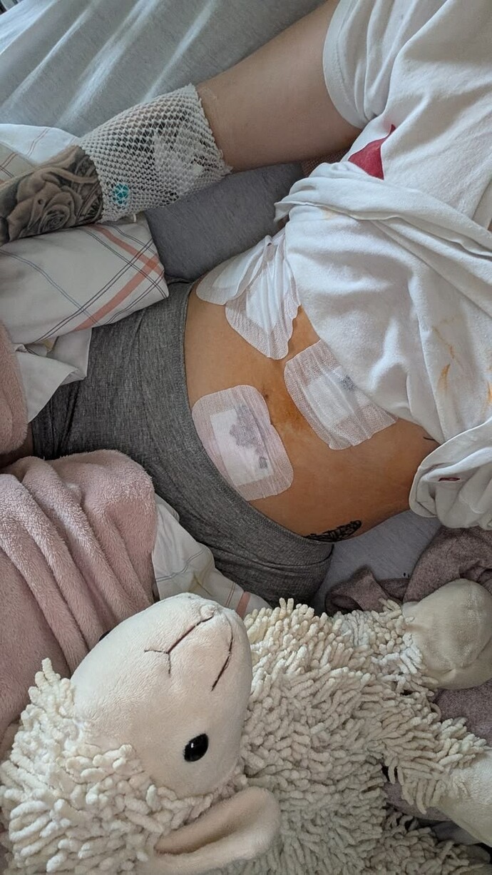 Rüzgar yaralarıma zarar verir mi, acıma ve yanmaya sebep olur mu?