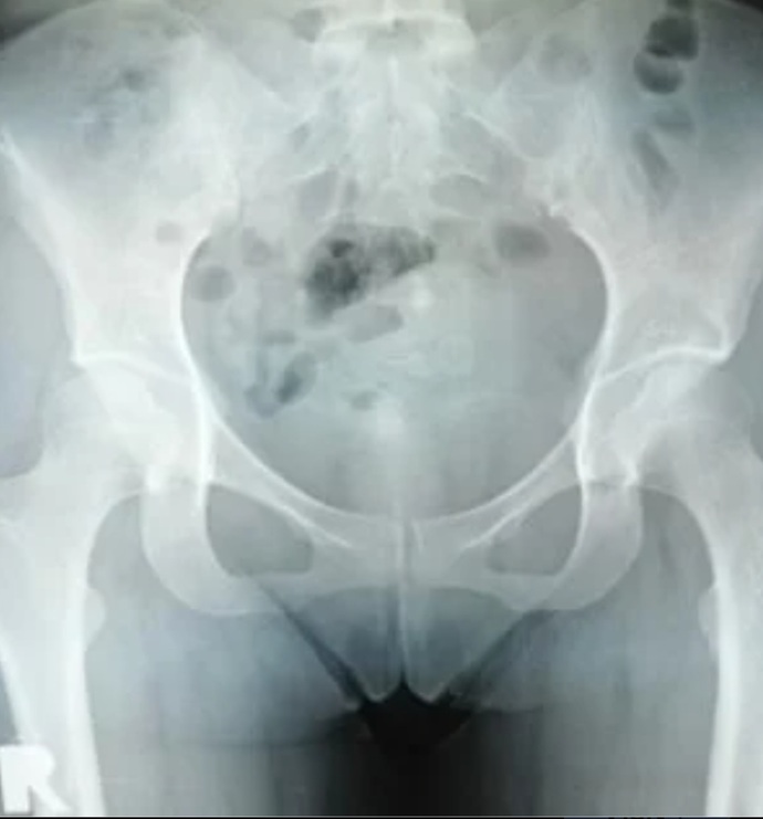 Off sizce benim sorunum ne doktor anlamiyor gibime geliyor?