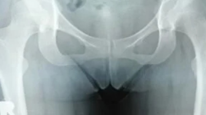 Off sizce benim sorunum ne doktor anlamiyor gibime geliyor?