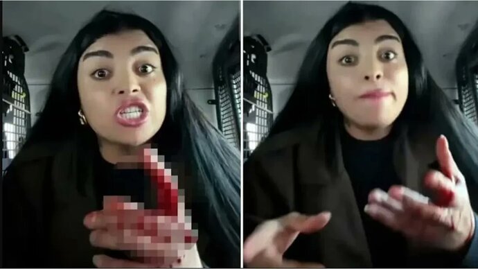 Karagülün bir kadını bıçaklayıp elinin kanıyla yayına devam etmesi sizce normal mi?