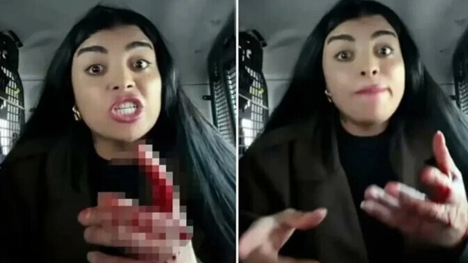 Karagülün bir kadını bıçaklayıp elinin kanıyla yayına devam etmesi sizce normal mi?