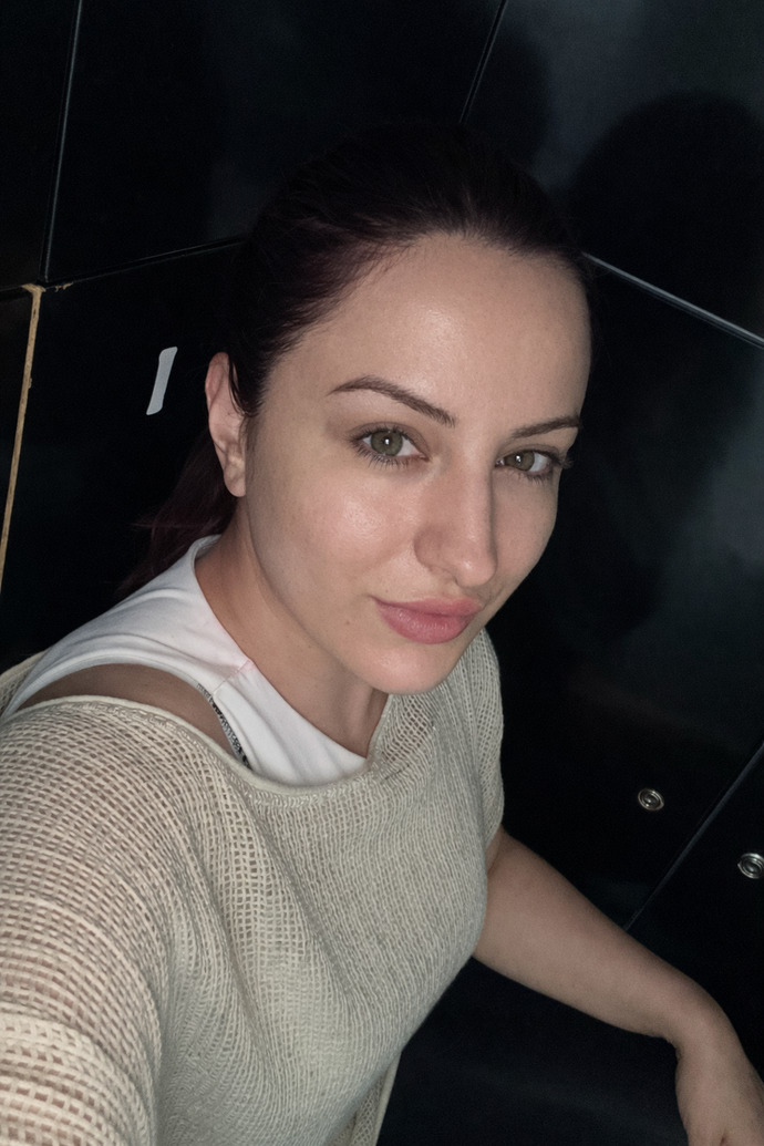 Yeni yaptırdığım mezoterapi cildime iyi gelmiş mi, sizce sonuç nasıl görünüyor?