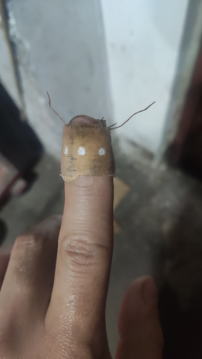 Yara bandımın antenlerinin çıkması şaka mı?