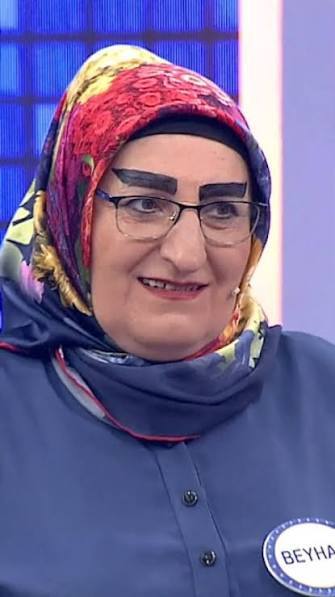 Hayatınızda böyle bir kaş gördünüz mü?