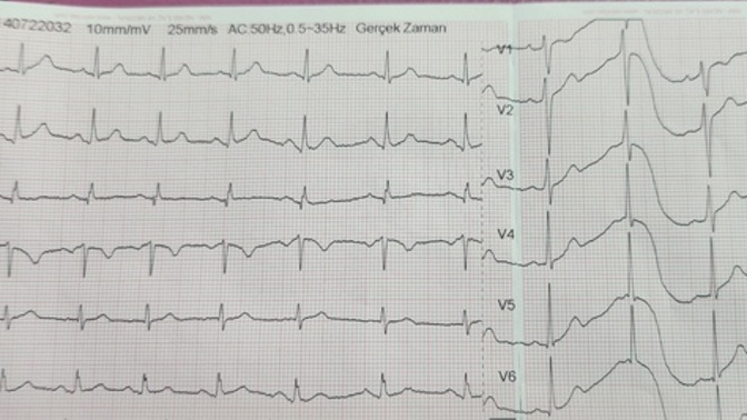 Doktor bir şey yok dedi , yapay zeka kalp krizi diyor, kafam karıştı ne yapmalıyım?