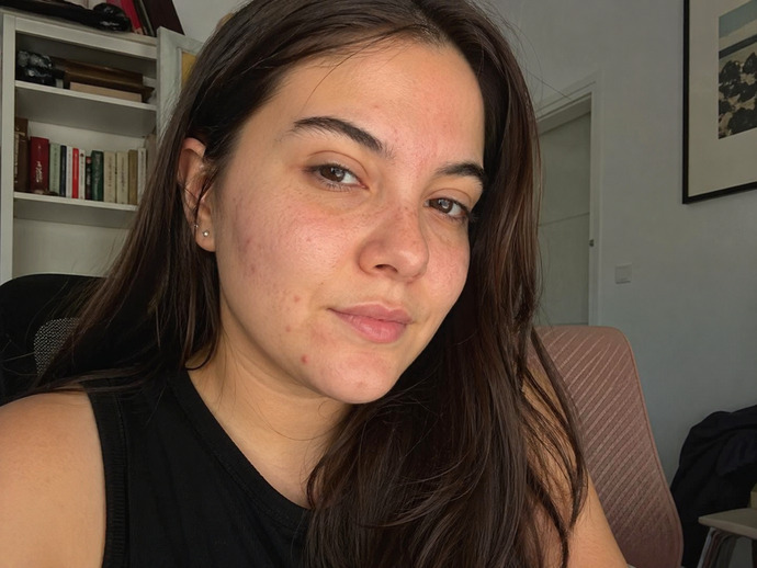 Sizce cirkin miyim kendimden nefret ediyorum off ve beni mutlu etmek icin yalan soylemeyin?