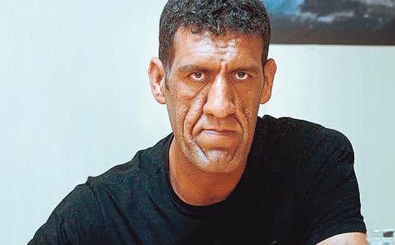 İş arkadaşım sürekli dış görünüşümle dalga geçiyor, sizce gerçekten çirkin miyim?