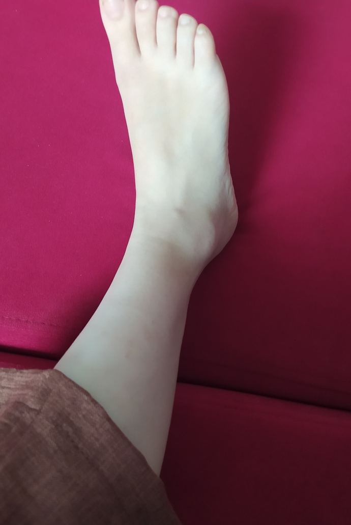 Ayağımı bilekten burktum, 1 haftadır ağrı ve şişlik geçmedi, evde ne yapmalıyım doktora gitmeli miyim?