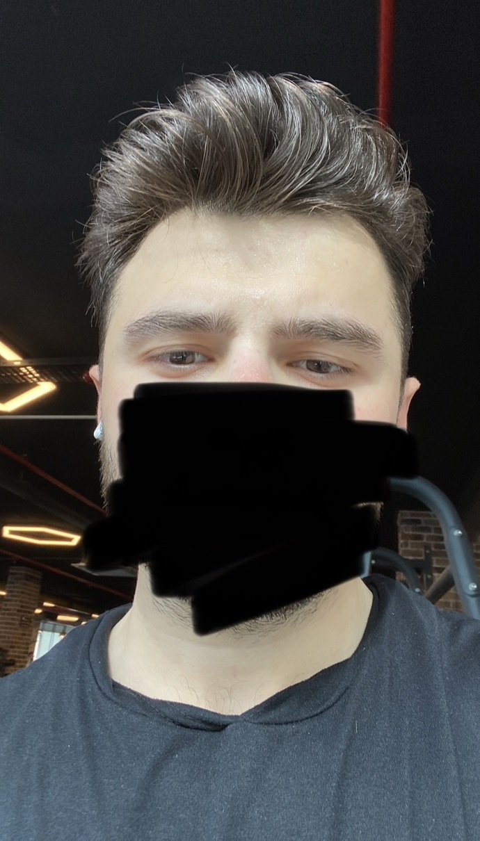 Benim gözümün yapısı badem göz mü oluyor?