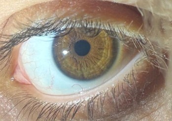 Ela göz mü kahverengi mi nasıl anlarım, hafif yeşil çizgiler ela sayılır mı?
