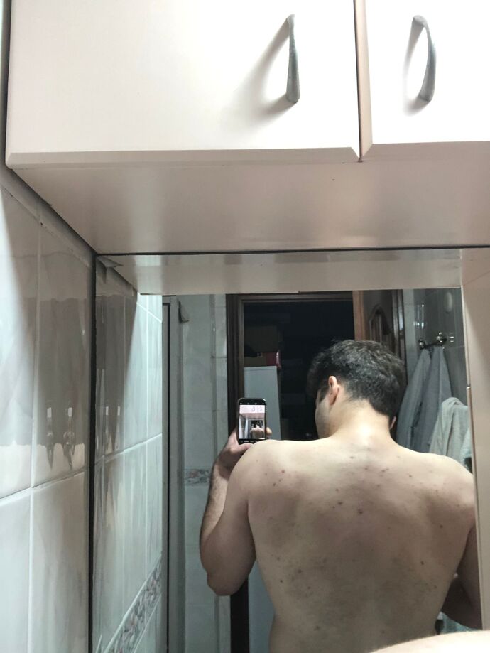 Ağırlık kaldırınca sırtım neden böyle oluyor?